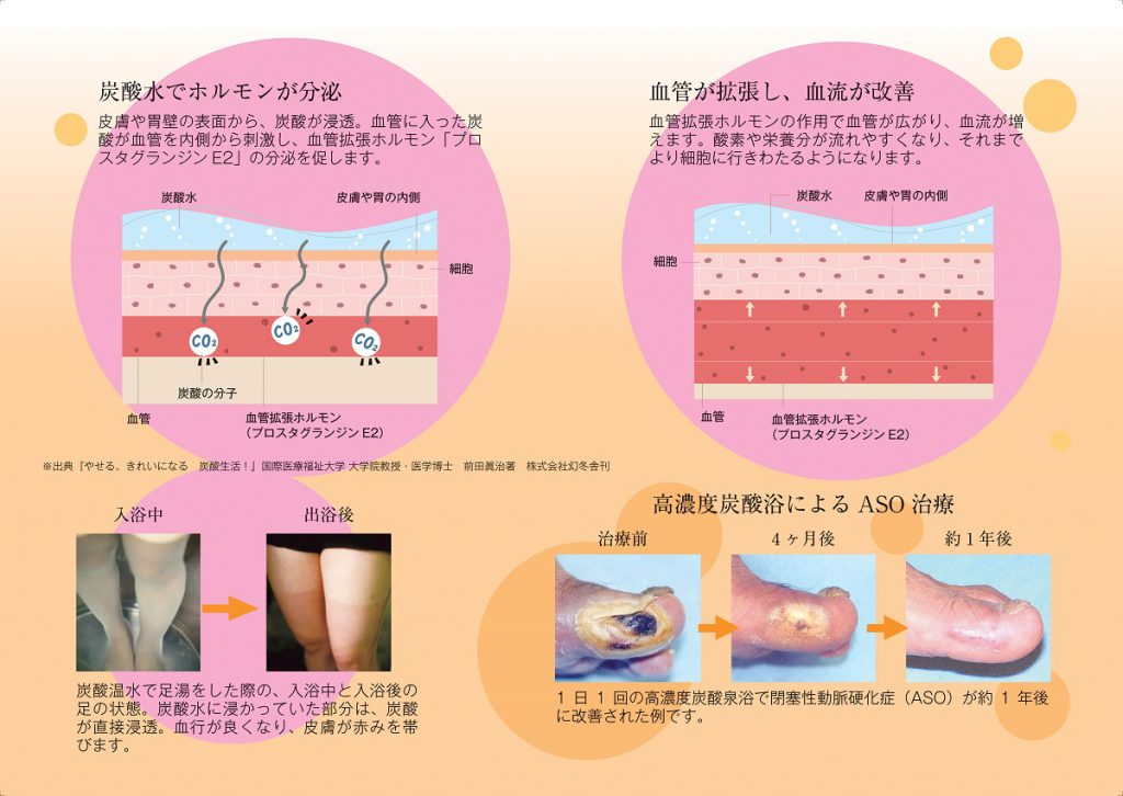 1300ppmの高濃度炭酸泉を導入 公式 ともいきの国 伊勢忍者キングダム 忍者 サムライの文化と和の美食を楽しむ街 1300ppmの高濃度炭酸泉を導入 公式 ともいきの国 伊勢忍者キングダム 忍者 サムライの文化と和の美食を楽しむ街